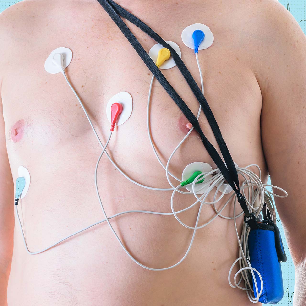 Cardioresp Κέντρο Καρδιοαναπνευστικών Παθήσεων